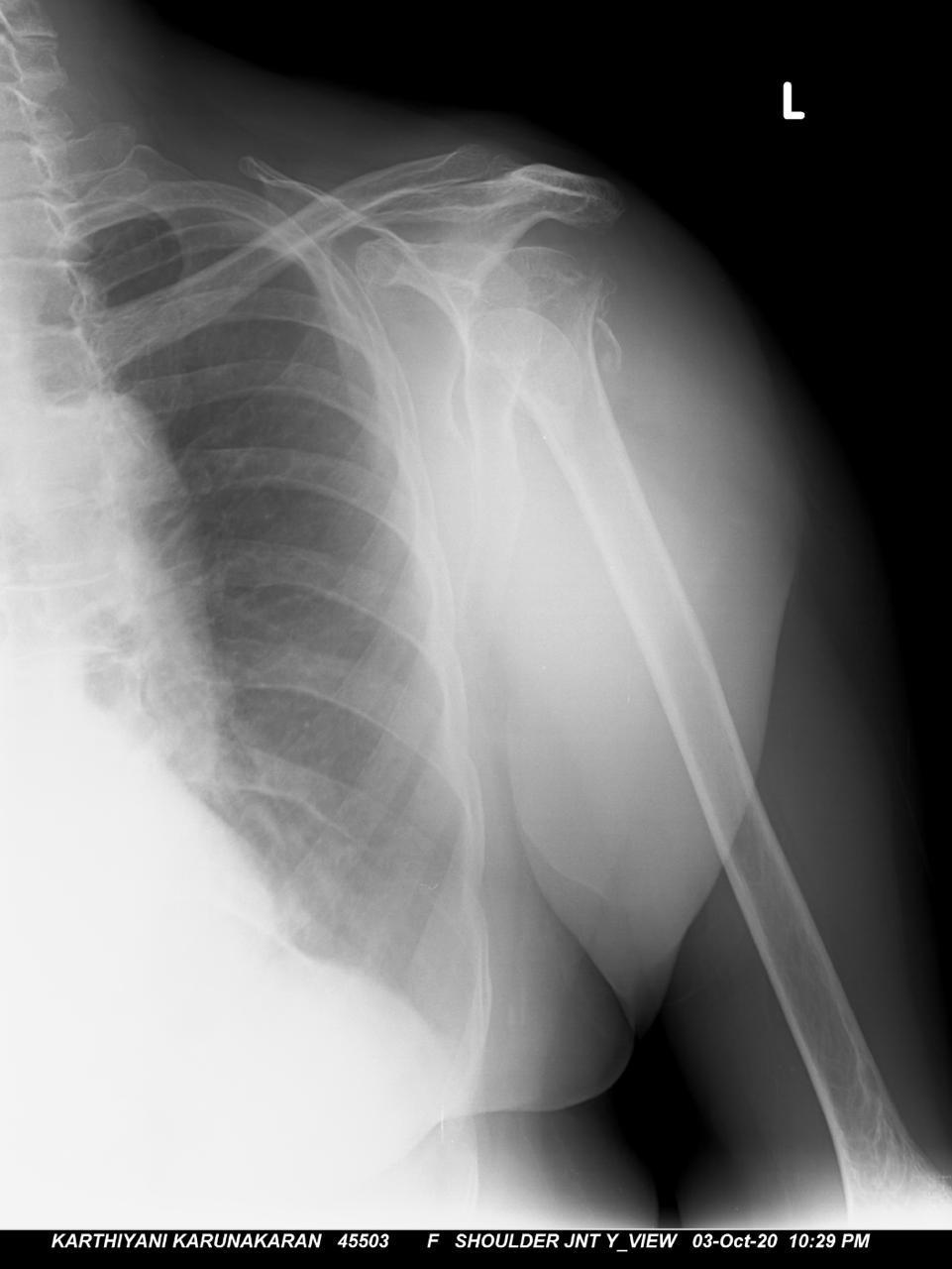 xray image